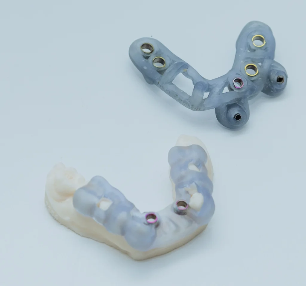 Impresión dental 3D en Bilbao