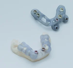 Impresión dental 3D en Bilbao